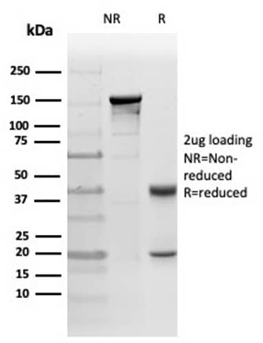 Formalin-fixed, paraffin-embedded cat liver stained with PKC iota Antibody (PRKCI/4911) - Azide and BSA Free.