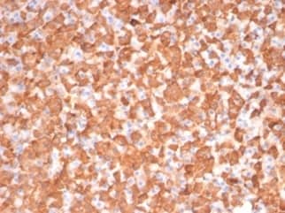 Formalin-fixed, paraffin-embedded dog liver stained with PKC iota Antibody (PRKCI/4911) - Azide and BSA Free. HIER: Tris/EDTA, pH9.0, 45min. 2 °: HRP-polymer, 30min. DAB, 5min.