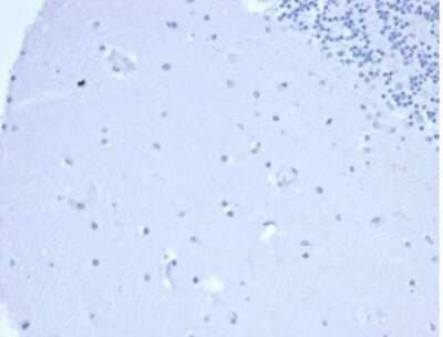 Immunohistochemistry-Paraffin: Prolactin Antibody (PRL/4906R) - Azide and BSA Free [NBP3-14158] - IHC analysis of formalin-fixed, paraffin-embedded human brain. Negative tissue control using Prolactin antibody (PRL/4906R) at 2ug/ml in PBS for 30min RT. HIER: Tris/EDTA, pH9.0, 45min. HRP-polymer, 30min. DAB, 5min.
