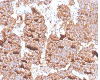 Immunohistochemistry-Paraffin: Prolactin Antibody (PRL/4906R) - Azide and BSA Free [NBP3-14158] - Formalin-fixed, paraffin-embedded human pituitary stained with Prolactin antibody (PRL/4906R).