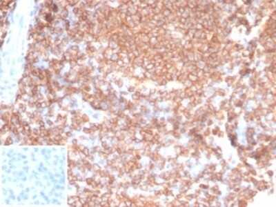 Immunohistochemistry-Paraffin: CD45RA Antibody (PTPRC/7019R) - Azide and BSA Free [NBP3-14161] - Formalin-fixed, paraffin-embedded human tonsil stained with CD45RA antibody (PTPRC/7019R). Inset: PBS instead of primary antibody; secondary only negative control.
