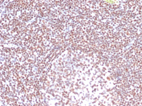 Formalin-fixed, paraffin-embedded human tonsil stained with RPA2 antibody (RPA2/4774).