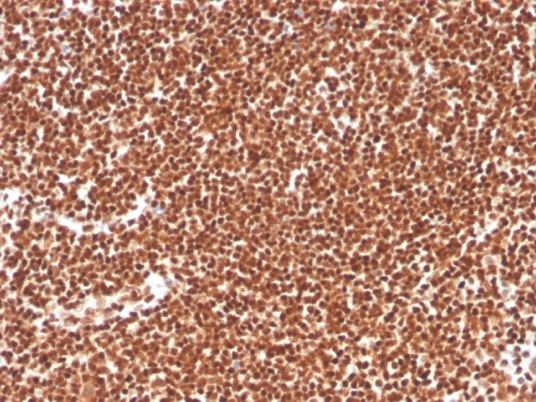 Formalin-fixed, paraffin-embedded human colon stained with RPA2 antibody (RPA2/4774).