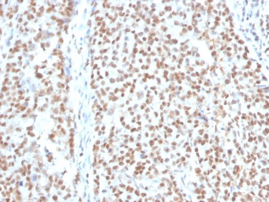 Formalin-fixed, paraffin-embedded human colon stained with RPA2 antibody (RPA2/4774).