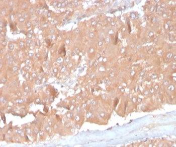 Formalin-fixed, paraffin-embedded human adrenal gland stained with CCL8/MCP-2 antibody (CCL8/3686). HIER: Tris/EDTA, pH9.0, 45min. Secondary: HRP-polymer, 30min. DAB, 5min.