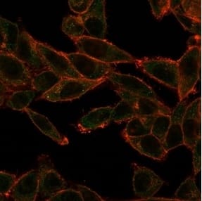 Immunofluorescence Analysis of PFA-fixed HeLa cells stained using SOX4 Antibody (PCRP-SOX4-1D6) - Azide and BSA Free followed by goat anti-mouse IgG-CF488 (green). CF640A phalloidin (red).