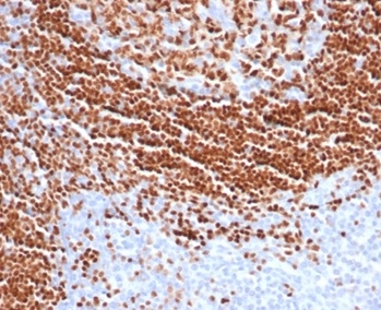 Formalin-fixed, paraffin-embedded human tonsil stained with SOX11 antibody (SOX11/7236). HIER: Tris/EDTA, pH9.0, 45min. Secondary: HRP-polymer, 30min. DAB, 5min.