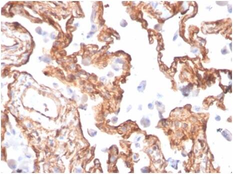 Formalin-fixed, paraffin-embedded human lung stained with Alpha Fodrin Antibody (SPTAN1/3505) - Azide and BSA Free.