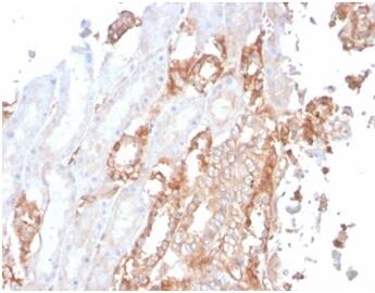 Formalin-fixed, paraffin-embedded human renal cell carcinoma stained with Alpha Fodrin Antibody (SPTAN1/3506) - Azide and BSA Free.