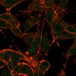 Immunofluorescence Analysis of PFA-fixed U87 cells stained using SURF5 Antibody (PCRP-MED22-2A7) - Azide and BSA Free followed by goat anti-mouse IgG-CF488. Membrane stained with phalloidin.