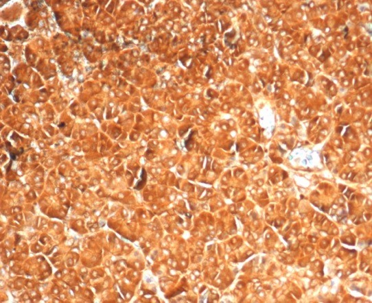 Formalin-fixed, paraffin-embedded human pancreas stained with Vinculin antibody (VCL/7091R) at 2ug/ml.