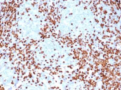 Immunohistochemistry-Paraffin: TdT Antibody (rDNTT/6909) - Azide and BSA Free [NBP3-14198] - Formalin-fixed, paraffin-embedded human thymus stained with TdT antibody (rDNTT/6909).
