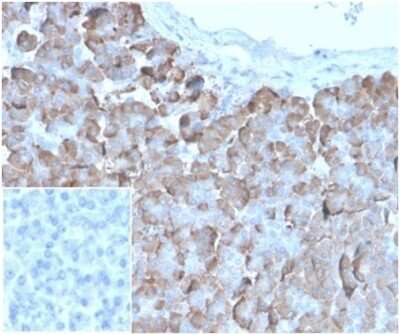 Immunohistochemistry-Paraffin: VLDLR Antibody (rVLDLR/1337) - Azide and BSA Free [NBP3-14200] - Formalin-fixed, paraffin-embedded human pancreas stained with VLDLR antibody (rVLDLR/1337). Inset: PBS instead of primary antibody; secondary only negative control.
