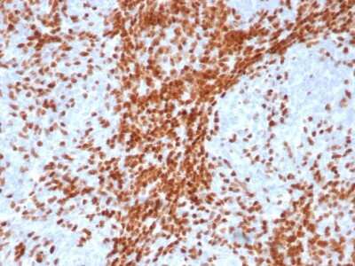 Immunohistochemistry-Paraffin: TdT Antibody (DNTT/4617R) - Azide and BSA Free [NBP3-14201] - Formalin-fixed, paraffin-embedded human thymus stained with TdT antibody (DNTT/4617R).