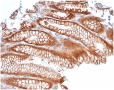 Immunohistochemistry-Paraffin: Reelin Antibody (RELN/4498) - Azide and BSA Free [NBP3-14203] - Formalin-fixed, paraffin-embedded human kidneystained with Reelin antibody (RELN/4498). Inset: PBS instead of primary antibody; secondary only negative control.