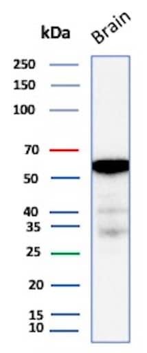 Western Blot Analysis of Human Brain tissue lysate using Aldehyde Dehydrogenase 1-A1/ALDH1A1 Antibody (ALDH1A1/7011R) - Azide and BSA Free.