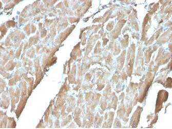 Formalin-fixed, paraffin-embedded human heart stained with FABP3/H-FABP Antibody (FABP3/3430) - Azide and BSA Free.