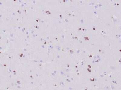 Immunohistochemistry-Paraffin: Olig2 Antibody (OLIG2/6695R) - Azide and BSA Free [NBP3-14217] - Formalin-fixed, paraffin-embedded human cerebrum stained with Olig2 antibody (OLIG2/6695R).