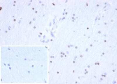 Immunohistochemistry-Paraffin: Olig2 Antibody (OLIG2/6695R) - Azide and BSA Free [NBP3-14217] - IHC analysis of formalin-fixed, paraffin-embedded human brain. Stained with Olig2 antibody (OLIG2/6695R) at 2ug/ml in PBS for 30min RT. Inset: PBS instead of primary; secondary antibody negative control.