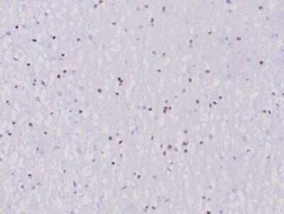 Immunohistochemistry-Paraffin: Olig2 Antibody (OLIG2/6695R) - Azide and BSA Free [NBP3-14217] - Formalin-fixed, paraffin-embedded human cerebellum stained with Olig2 antibody (OLIG2/6695R).