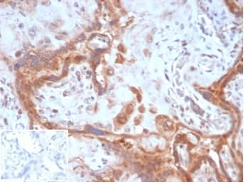 Formalin-fixed, paraffin-embedded human placenta stained with Fibroblast Activation Protein alpha/FAP Antibody (FAP/4851) - Azide and BSA Free. Inset: PBS instead of primary antibody, secondary only negative control.
