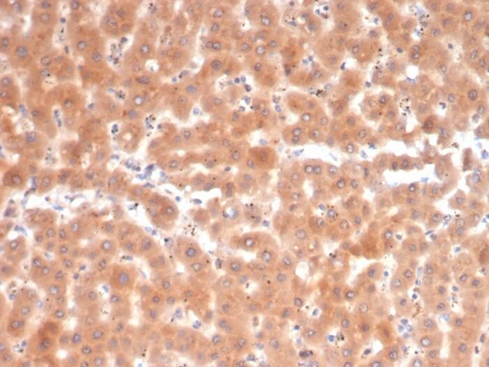 Formalin-fixed, paraffin-embedded human liver stained with Fibroblast Activation Protein alpha/FAP Antibody (FAP/4853) - Azide and BSA Free.