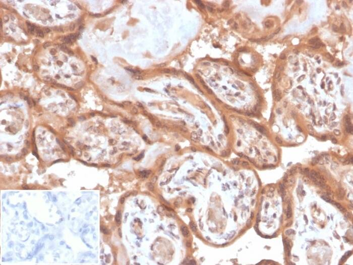 Formalin-fixed, paraffin-embedded human placenta stained with Fibroblast Activation Protein alpha/FAP Antibody (FAP/4853) - Azide and BSA Free. Inset: PBS instead of primary antibody, secondary only negative control.