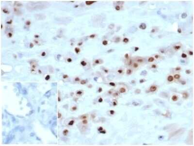 Immunohistochemistry-Paraffin: p57 Kip2 Antibody (KIP2/7083R) - Azide and BSA Free [NBP3-14222] - IHC analysis of formalin-fixed, paraffin-embedded human placenta. Strong nuclear staining using p57 Kip2 antibody (KIP2/7083R) at 2ug/ml in PBS for 30min RT. Inset: PBS instead of primary antibody; secondary only negative control.