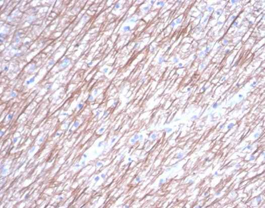 Formalin-fixed, paraffin-embedded human brain stained with beta-III Tubulin antibody (TUBB3/7089R).