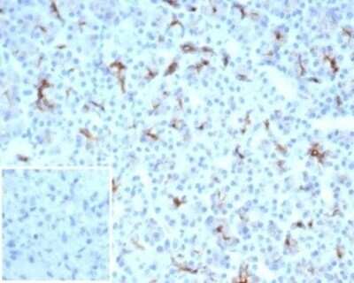 Immunohistochemistry-Paraffin: CFTR Antibody (CFTR/7003R) - Azide and BSA Free [NBP3-14272] - Formalin-fixed, paraffin-embedded human spleen stained with CFTR antibody (CFTR/7003R). Inset: PBS instead of primary antibody; secondary only negative control.