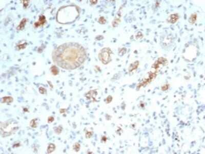 Immunohistochemistry-Paraffin: CFTR Antibody (CFTR/7003R) - Azide and BSA Free [NBP3-14272] - Formalin-fixed, paraffin-embedded human kidney stained with CFTR antibody (CFTR/7003R). Inset: PBS instead of primary antibody; secondary only negative control.