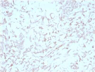 Immunohistochemistry-Paraffin: MIG2/Kindlin-2 Antibody (3A3) - Azide and BSA Free [NBP3-14275] - Formalin-fixed, paraffin-embedded human liver stained with MIG2/Kindlin-2 antibody (3A3).