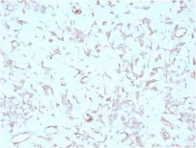 Immunohistochemistry-Paraffin: MIG2/Kindlin-2 Antibody (3A3) - Azide and BSA Free [NBP3-14275] - Formalin-fixed, paraffin-embedded human liver stained with MIG2/Kindlin-2 antibody (3A3).