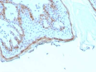 Immunohistochemistry-Paraffin: Filaggrin Antibody (rFLG/1945) - Azide and BSA Free [NBP3-14280] - Formalin-fixed, paraffin-embedded human skin stained with Filaggrin antibody (rFLG/1945).