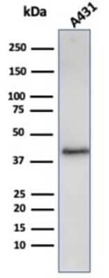 Western Blot: Filaggrin Antibody (FLG/3909R) - Azide and BSA Free [NBP3-14281] - Western Blot Analysis of A431 cell lysate using Filaggrin antibody (FLG/3909R).