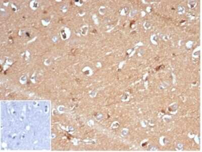Immunohistochemistry-Paraffin: AKR1B1 Antibody (AKR1B1/7009R) - Azide and BSA Free [NBP3-14283] - IHC analysis of formalin-fixed, paraffin-embedded human brain. Staining using AKR1B1 antibody (AKR1B1/7009R) at 2ug/ml in PBS for 30min RT. Inset: PBS instead of primary antibody; secondary only negative control.