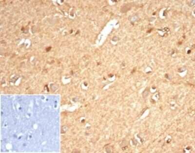 Immunohistochemistry-Paraffin: AKR1B1 Antibody (AKR1B1/7010R) - Azide and BSA Free [NBP3-14284] - IHC analysis of formalin-fixed, paraffin-embedded human brain. Staining using AKR1B1 antibody (AKR1B1/7010R) at 2ug/ml in PBS for 30min RT. Inset: PBS instead of primary antibody; secondary only negative control.