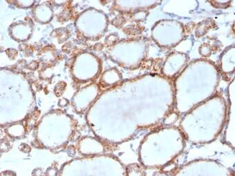 IHC analysis of formalin-fixed, paraffin-embedded human thyroid. Staining using RHOBTB2 Antibody (DBC2/3361) - Azide and BSA Free at 2ug/ml in PBS for 30min RT.