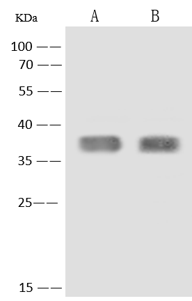 Western Blot: C3orf38 Antibody [NBP3-14644] - NBP3-14644 at 1:500 dilution. Lane A: U87-MG Whole Cell Lysate. Lane B: Caco-2 Whole Cell Lysate. Lysates/proteins at 30 ug per lane.Secondary: HRP-conjugated Goat Anti-Rabbit IgG (H+L) at 1/10000 dilution. Developed using the ECL technique. Performed under reducing conditions. Predicted band size: 37 kDa. Observed band size: 37 kDa
