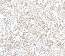 Immunohistochemistry-Paraffin: CD96 Antibody [NBP3-14682] -Rabbit anti-CD96 recombinant monoclonal antibody[BLR065G].  Secondary: HRP-conjugatedgoat anti-rabbit IgG.  Substrate: DAB.