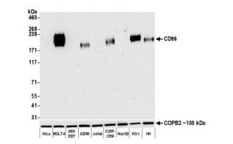 Western Blot: CD96 Antibody [NBP3-14682] -Whole cell lysate (10 µg) from HeLa, MOLT-4, HEK293T,A2058, Jurkat, CCRF-CEM, Hep-G2, KG-1, and HH cellsprepared using NETN lysis buffer. Antibody: Rabbit antiCD96 recombinant monoclonal antibody used at 1:1000. Secondary: HRPconjugated goat anti-rabbit IgG. Chemiluminescence with an exposure time of 3 minutes.