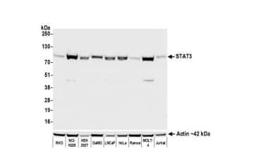 Whole cell lysate (50 µg) from RKO, NCI-H226, HEK293T,GaMG, LNCaP, HeLa, Ramos, MOLT-4, and Jurkat cellsprepared using NETN lysis buffer. Antibody: Rabbit antiSTAT3 recombinant monoclonal antibody [BLR098G] used at 1:1000. Secondary: HRPconjugated goat anti-rabbit IgG. Chemiluminescence with an exposure time of 10 seconds.Lower Panel: Rabbit anti-Actin recombinant monoclonalantibody [BLR057F].