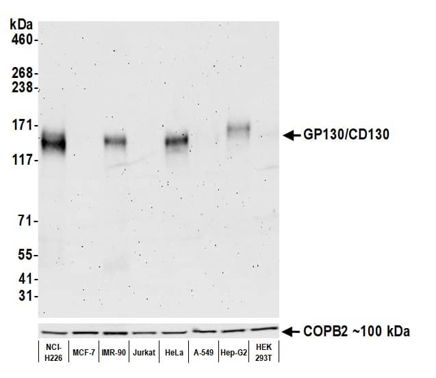 Western Blot;gp130/CD130 Antibody (BLR114H)  Whole cell lysate (50 µg) from NCI-H226, MCF-7, IMR-90, Jurkat, HeLa, A-549, Hep-G2, and HEK293T cells prepared using NETN lysis buffer. Antibody: Rabbit anti-GP130/CD130 recombinant monoclonal antibody   used at 1:1000. Secondary: HRP-conjugated goat anti-rabbit IgG . Detection: Chemiluminescence with an exposure time of 30 seconds. Lower Panel: Rabbit anti-COPB2.