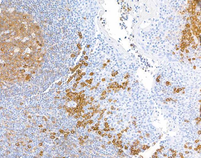 Detection of human CD38 in FFPE tonsil by immunohistochemistry.Antibody: Rabbit anti-CD38 recombinant monoclonal antibody [BLR123H] NBP3-14707 Lot 1). Secondary: HRP-conjugated goat anti-rabbit IgG . Substrate: DAB.