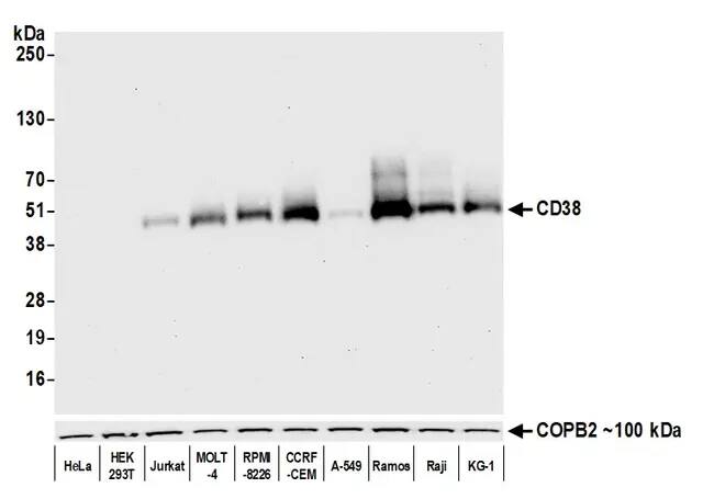 Detection of human CD38 by western blot.Samples: Whole cell lysate (10 ug) from HeLa, HEK293T, Jurkat, MOLT-4, RPMI-8226, CCRF-CEM, A-549, Ramos, Raji, and KG-1 cells prepared using NETN lysis buffer. Antibody: Rabbit anti-CD38 recombinant monoclonal antibody [BLR123H] (NBP3-14707 lot 1) used at 1:1000. Secondary: HRP-conjugated goat anti-rabbit IgG (A120-101P). Detection: Chemiluminescence with an exposure time of 10 seconds. Lower Panel: Rabbit anti-COPB2 antibody.