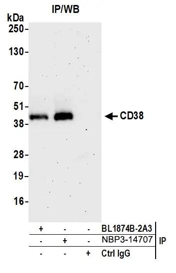 Detection of human CD38 by western blot of immunoprecipitates.Samples: Whole cell lysate (1.0 mg per IP reaction; 2% of IP loaded) from Ramos cells prepared using NETN lysis buffer. Antibodies: Rabbit anti-CD38 recombinant monoclonal antibody [BLR123H] (NBP3-14707 lot 1) used for IP at 20 ul/mg lysate. CD38 was also immunoprecipitated by rabbit anti-CD38 antibody BL1874B-2A3. For blotting immunoprecipitated CD38, NBP3-14707 was used at 1:1000. Detection: Chemiluminescence with an exposure time of 75 seconds.