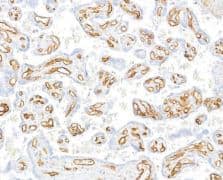 Immunohistochemistry-Paraffin: CD31/PECAM-1 Antibody (BLR127H) [NBP3-14710] -: Rabbit antiCD31/PECAM-1 recombinant monoclonal antibody[BLR127H].  Secondary: HRP-conjugated goat anti-rabbit IgG.Substrate: DAB.