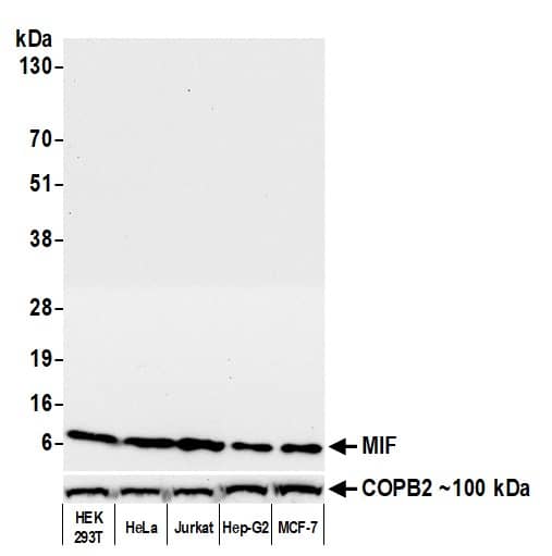 Western Blot;MIF Antibody (BLR141J)  Whole cell lysate (25 µg) from HEK293T, HeLa, Jurkat, Hep-G2, and MCF-7 cells prepared using NETN lysis buffer. Antibody: Rabbit anti-MIF recombinant monoclonal antibody  used at 1:1000. Secondary: HRP-conjugated goat anti-rabbit IgG . Detection: Chemiluminescence with an exposure time of 10 seconds. Lower Panel: Rabbit anti-COPB2 antibody.