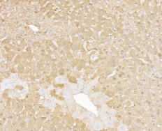 Rabbit anti-Arginase 1 recombinant monoclonal antibody [BLR161J]. Secondary: HRP-conjugated goat anti-rabbit IgG Substrate: DAB.