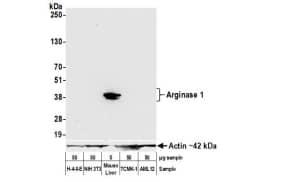 Lysate from from H-4-II-E, NIH 3T3, mouse liver, TCMK-1,and AML12 cells. Antibody: Rabbit anti-Arginase-1recombinant monoclonal antibody [BLR161J]  used at 1:1000. Secondary: HRP-conjugated goat antirabbit IgG. Chemiluminescence with anexposure time of 30 seconds. Lower Panel: Rabbit antiActin recombinant monoclonal antibody [BLR057F]